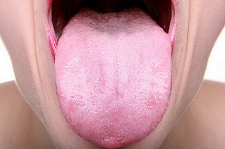 bledý-jazyk
