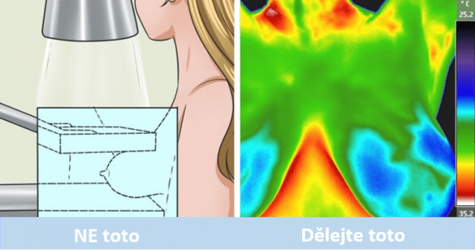 mamograf_vs_termograf