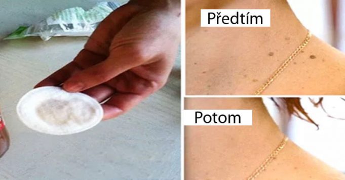 Odstraňte-bradavice-vyrážky-a-znaménka-na-pokožce-s-tímto-přírodním-receptem