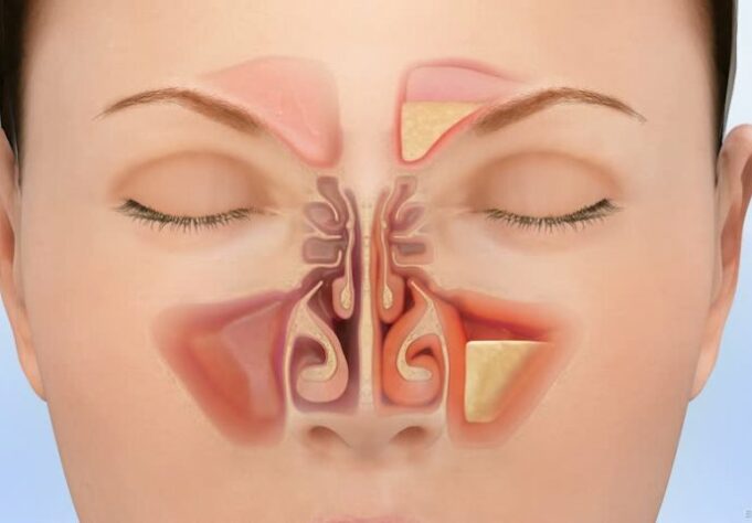 61a7e47b-59d8-420e-b513-4e970a0a0a64-13643205625924-fullscreen-poster-690x480