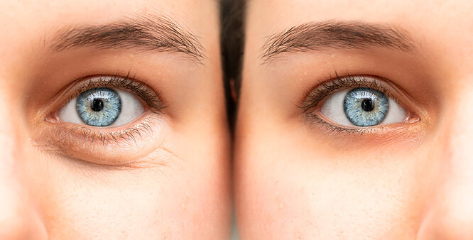 4ba2f1ff386e3cc907a663b21f6a40cd_cropped_666x338
