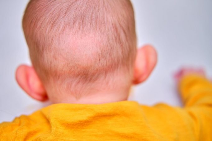 Bald spot on the back of the infant baby head. Rubbed hair of the toddler child