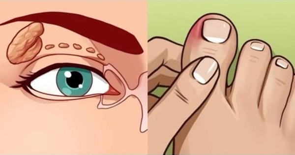 620
