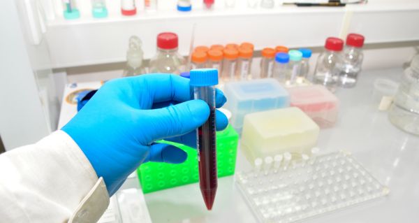 Přelomová studie varuje některé kombinace antibiotik a léků mohou být problém